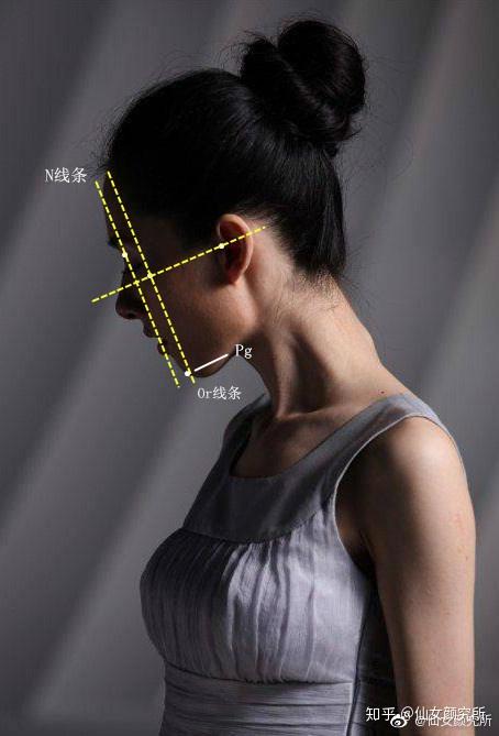 产生嘴凸,下巴后缩的感觉;如果sn点靠后,pg点靠前,则可能是凹面型脸