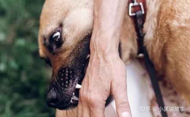 河南3岁男童被恶犬咬伤18天后离世,母亲说尽快找到狗主人! - 知乎