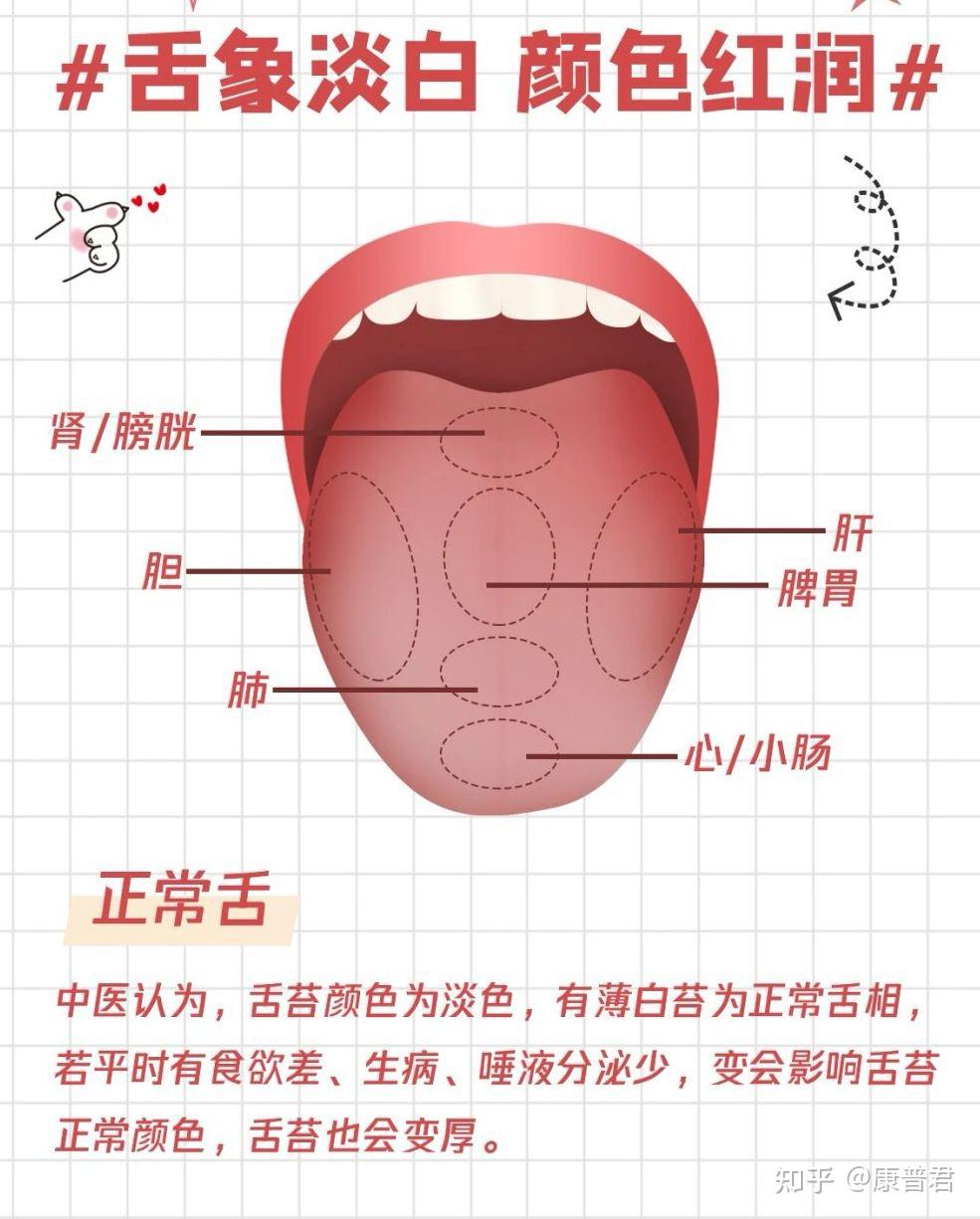 一张图让你简单看懂中医舌诊!