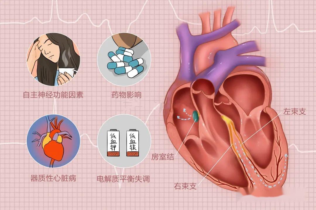 房颤也会引起脑中风吗它有何特点房颤发生时有哪些临床表现如何积极