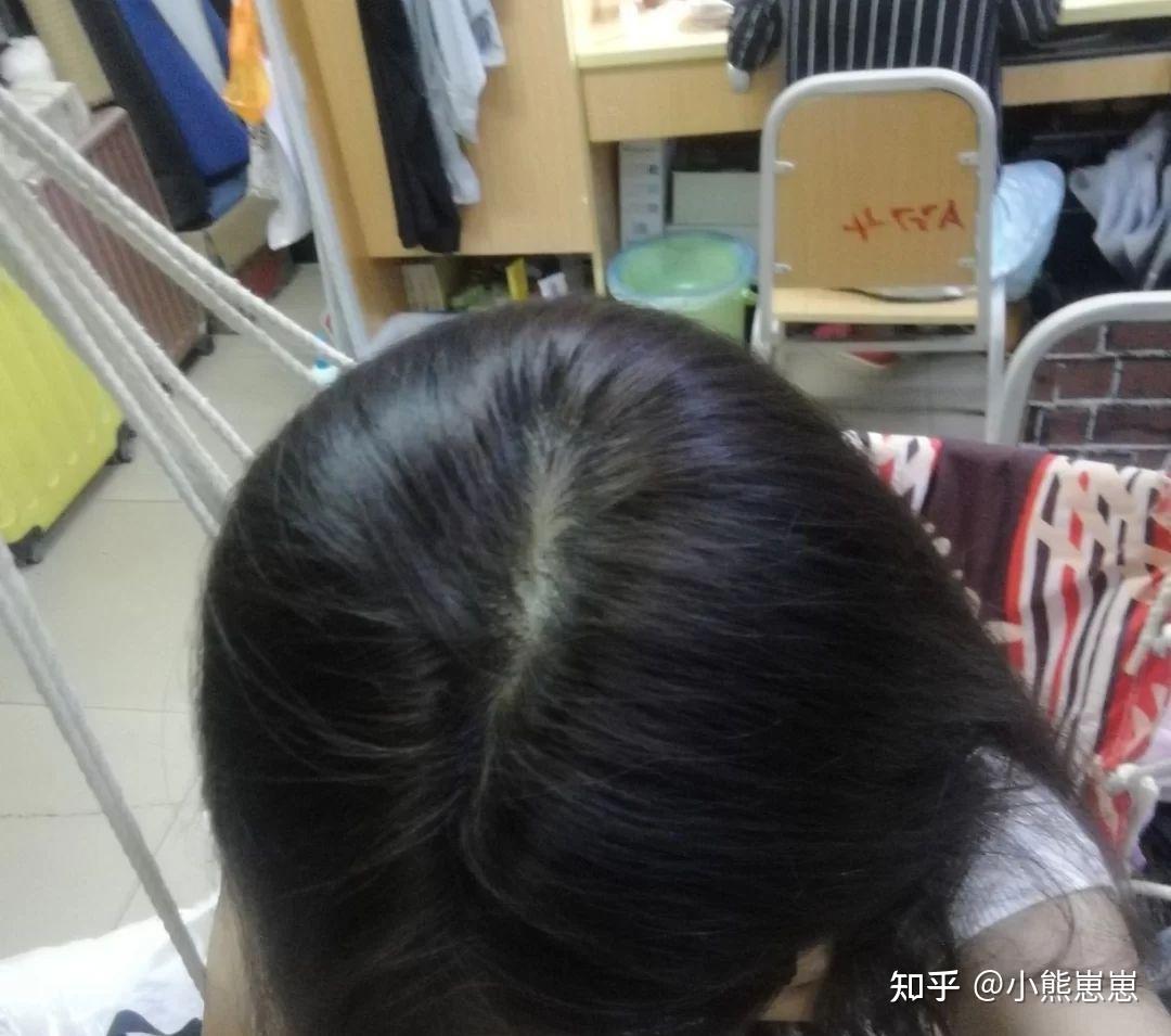 头发多的女生都是怎么养发育发的? - 知乎