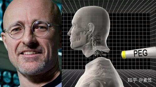 换头手术真实成功了吗 v2-e505fe7b4cd24fe82a6da33ed5bcadd1_r.jpg