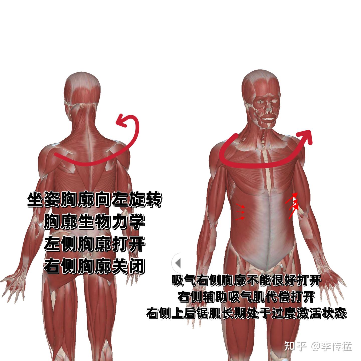 上背疼痛、大小胸、右肩疼痛 - 知乎