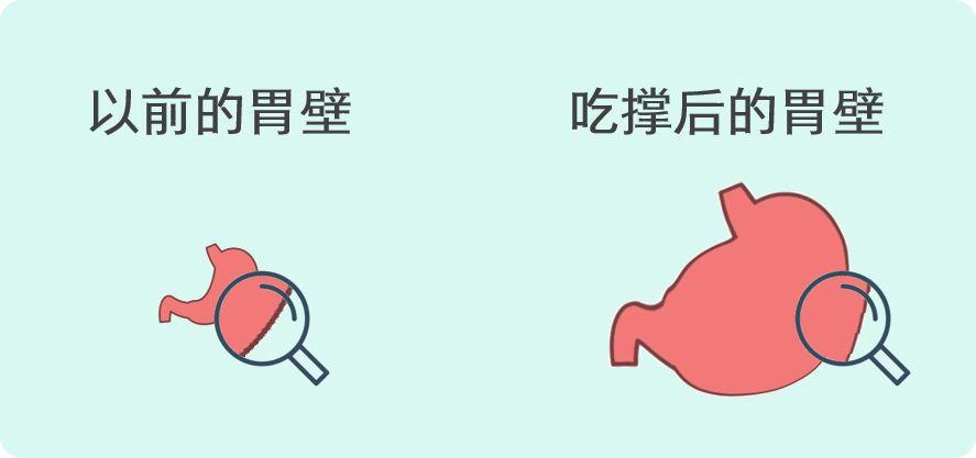 经常吃太撑,胃会发生什么变化? - 知乎