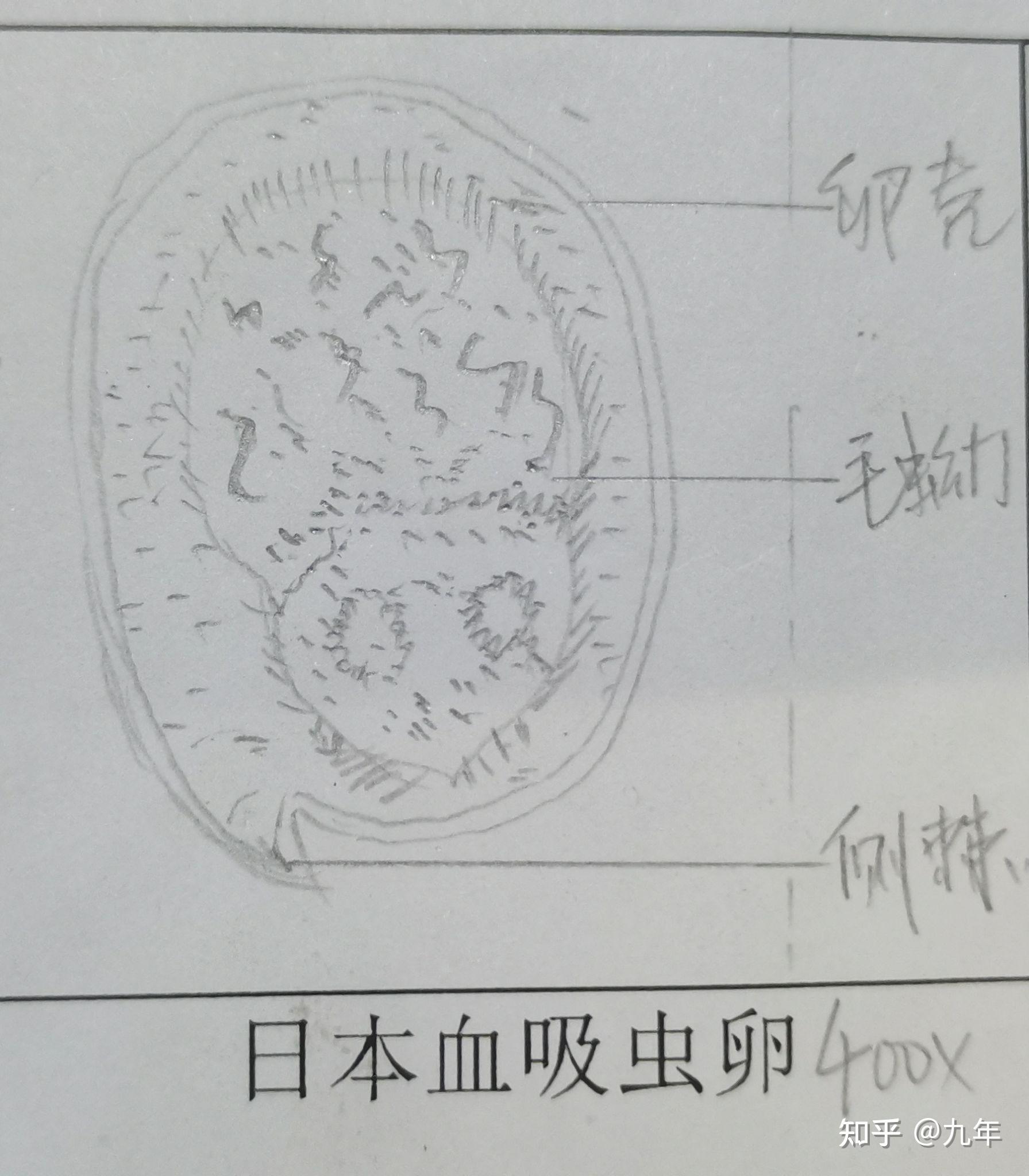 布氏姜片虫虫卵手绘图图片