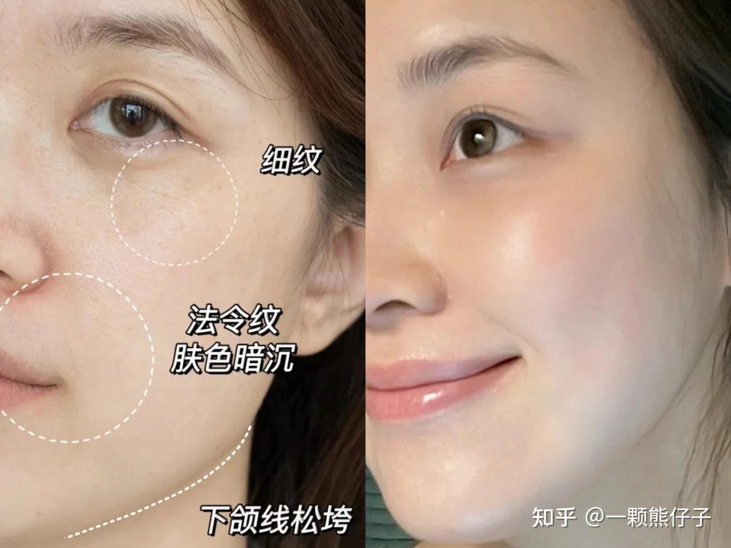 胶原蛋白是智商税?一个长期补充胶原蛋白的人,最后成了什么样? - 知乎