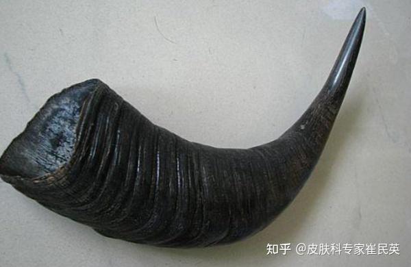 善治黧黑斑的凉血消斑方 - 知乎
