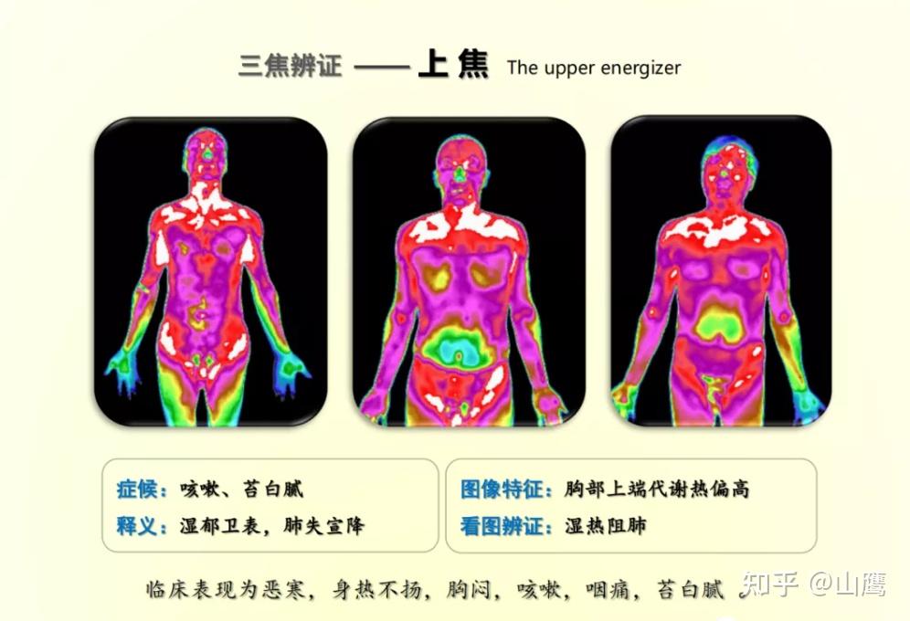 红外热成像在中医三焦辩证应用浅析