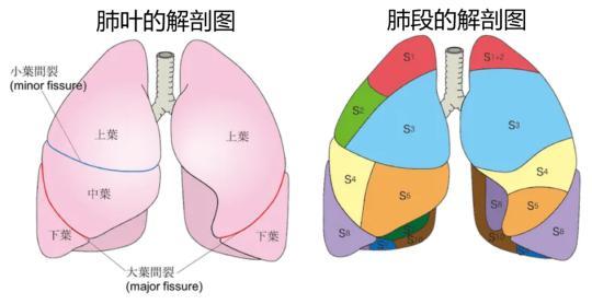 肺腑之谈,胸中有术——肺癌手术的常见方式及术后并发症