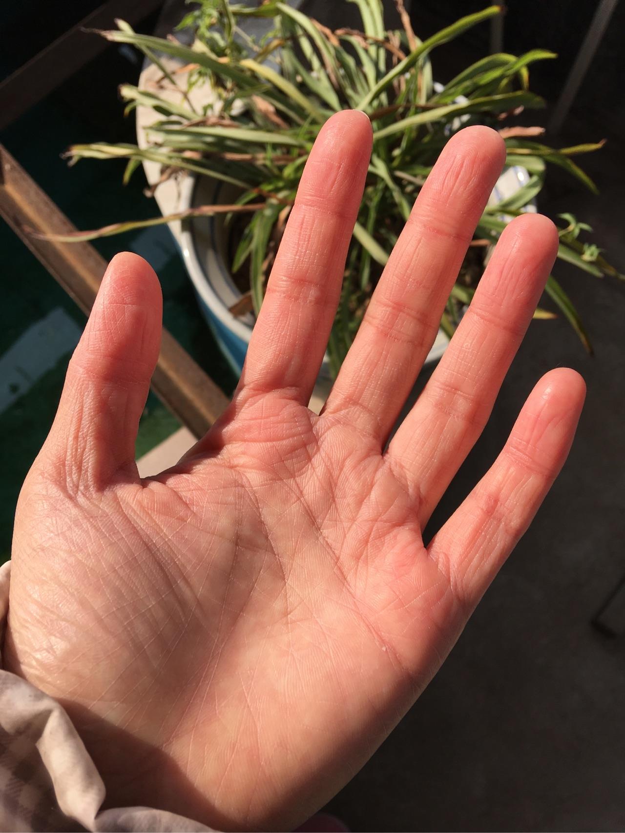 手粗糙成这样,还有救吗? - 知乎