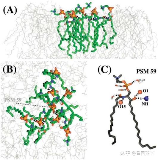 NiemannPick disease 知乎