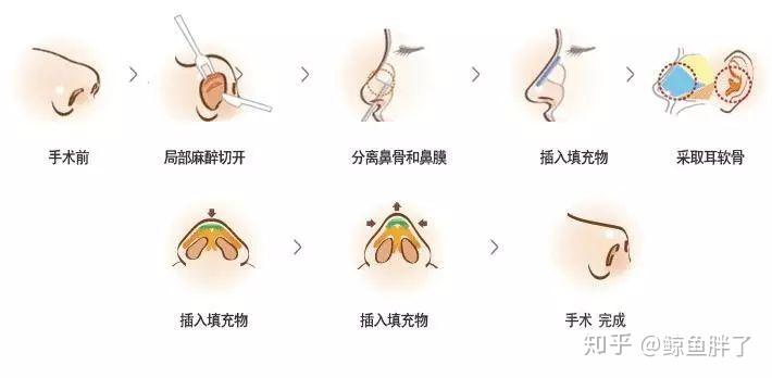 成都整形医院：美丽背后的智慧之选