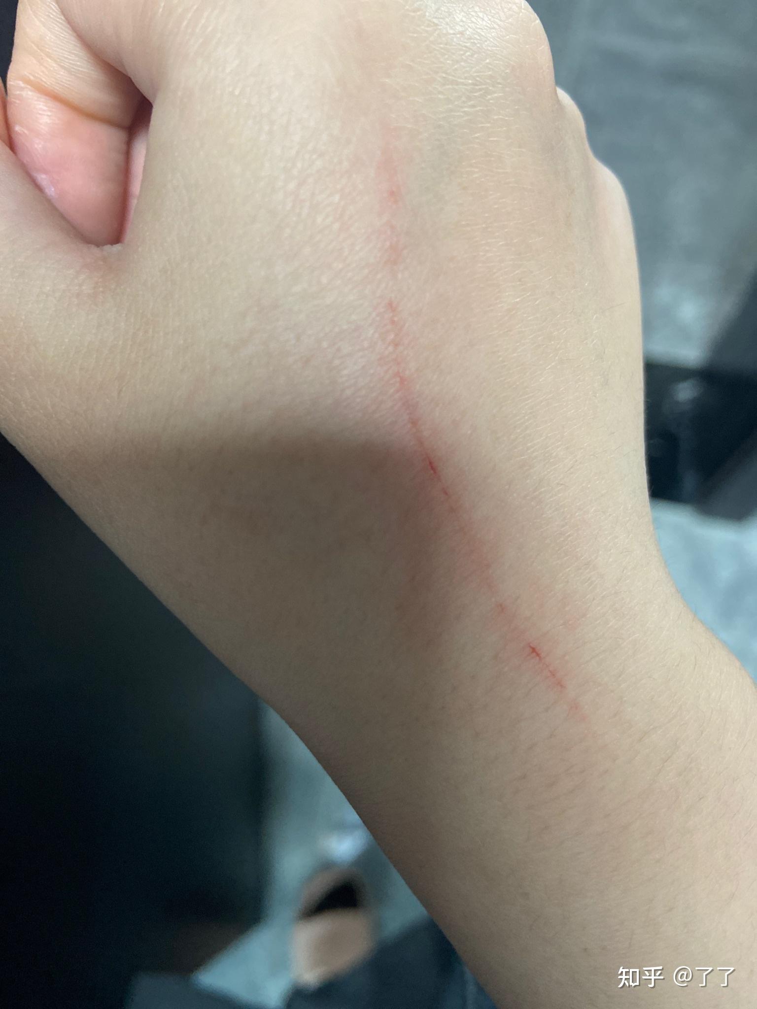 被狗笼划出血需要干什么