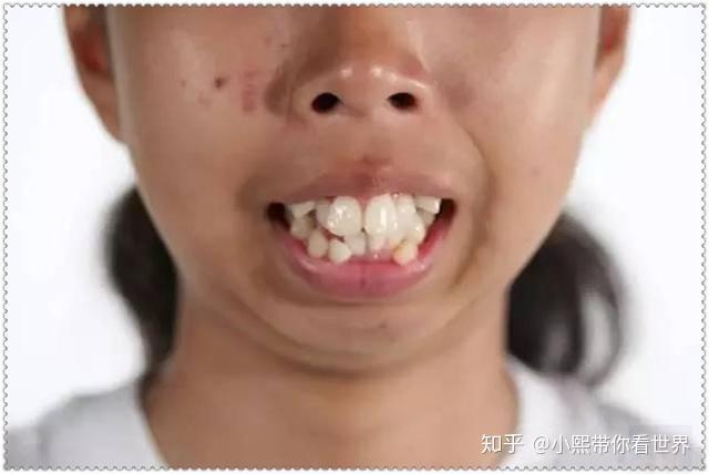 韩国推行从小美容孩子干净的童年哪去了幕后推手可不止家长