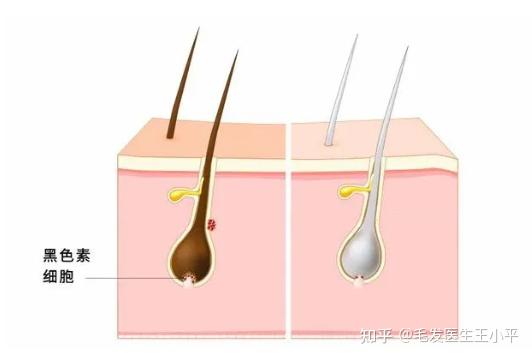 《趣味毛发100问》5:身体缺什么头发会变白? - 知乎