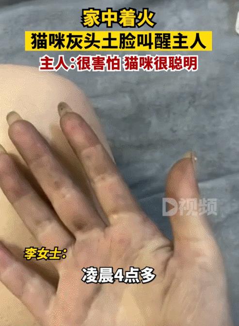 笑死,火灾中被救的猫,俄罗斯猫:谁放火烧老子,生吃了你!