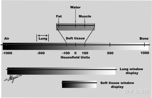 现代医学成像（3）——CT（基本原理与图像重建） - 知乎