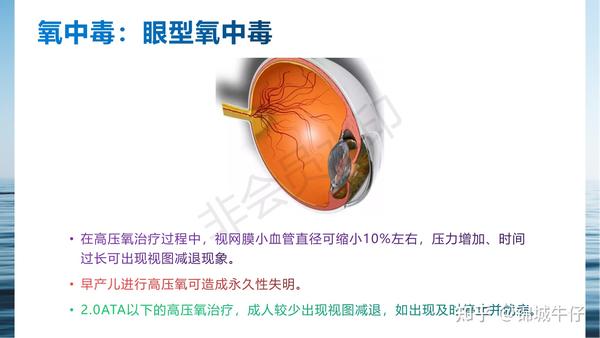 高压氧治疗的副作用和禁忌症 - 知乎