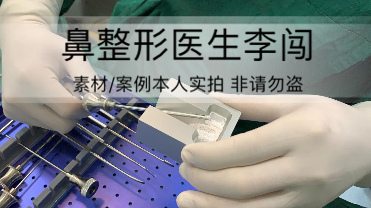 珊瑚骨 禁品 骨粉 换汤不换药 知乎 珊瑚骨 禁品 骨粉 换汤不换药 知乎