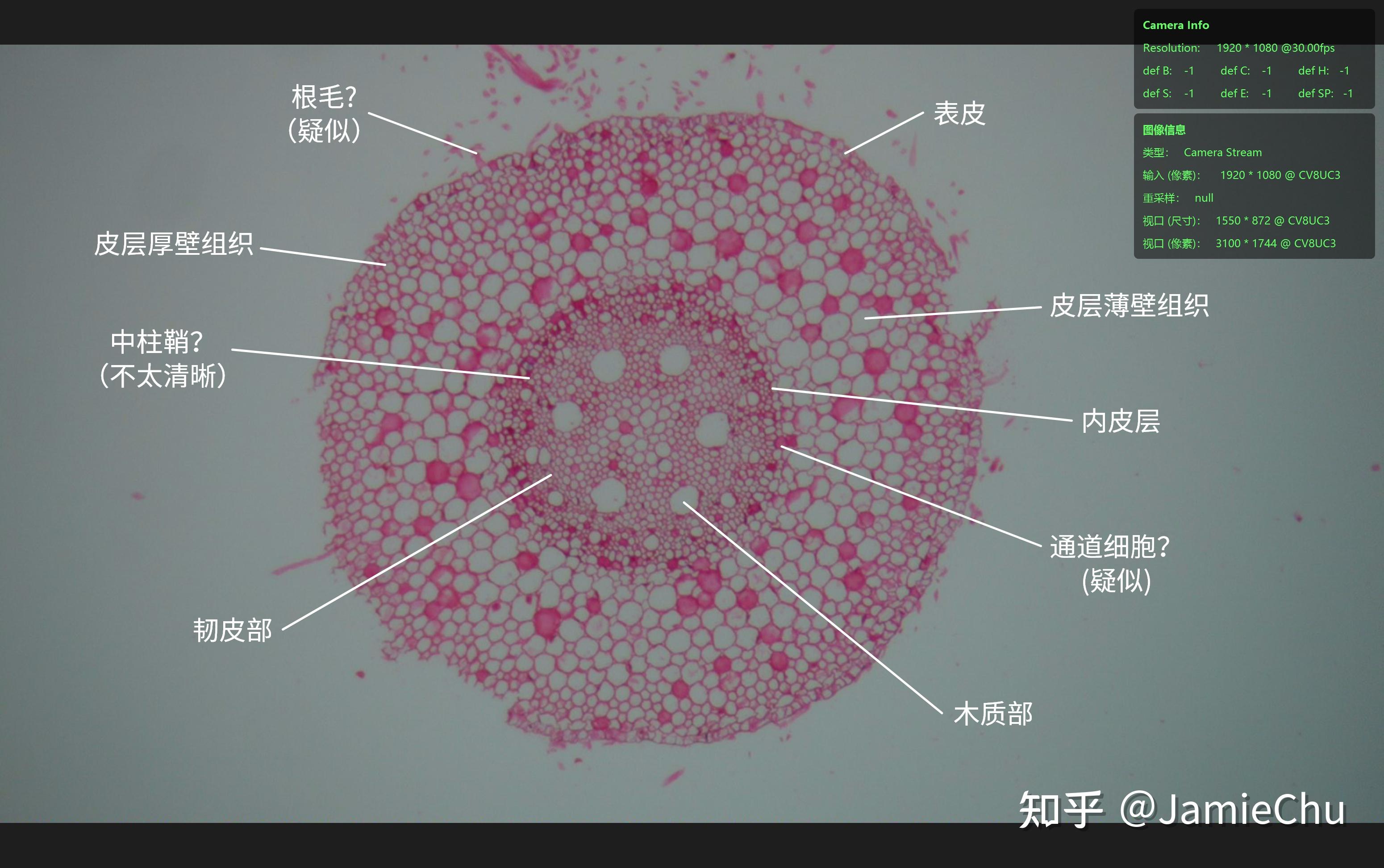 蚕豆下表皮细胞结构图图片