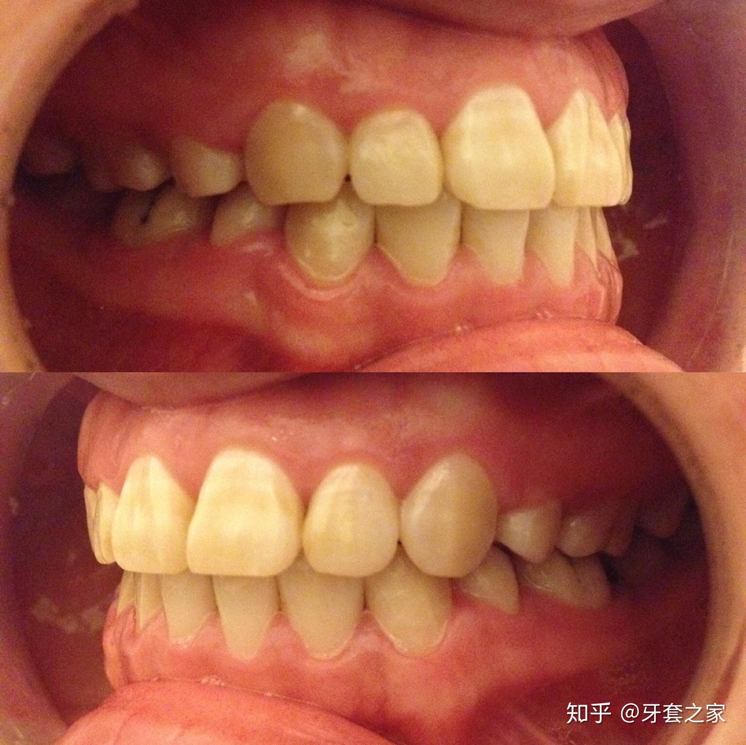 v2-e819b4cd4b53b457d177f350bee768e9_r.jpg