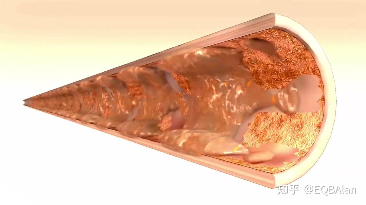 管刷在线自动清洗冷凝器不需要更多的人工通炮 - 知乎