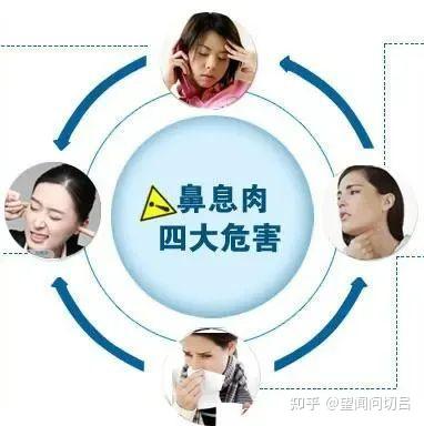 鼻子闻不到味道?头痛?有可能是鼻息肉引发 - 知乎