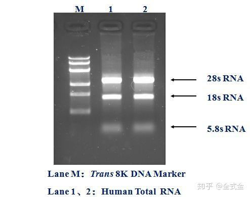 从RNA提取到qPCR 高品质RNA模板制备 - 知乎