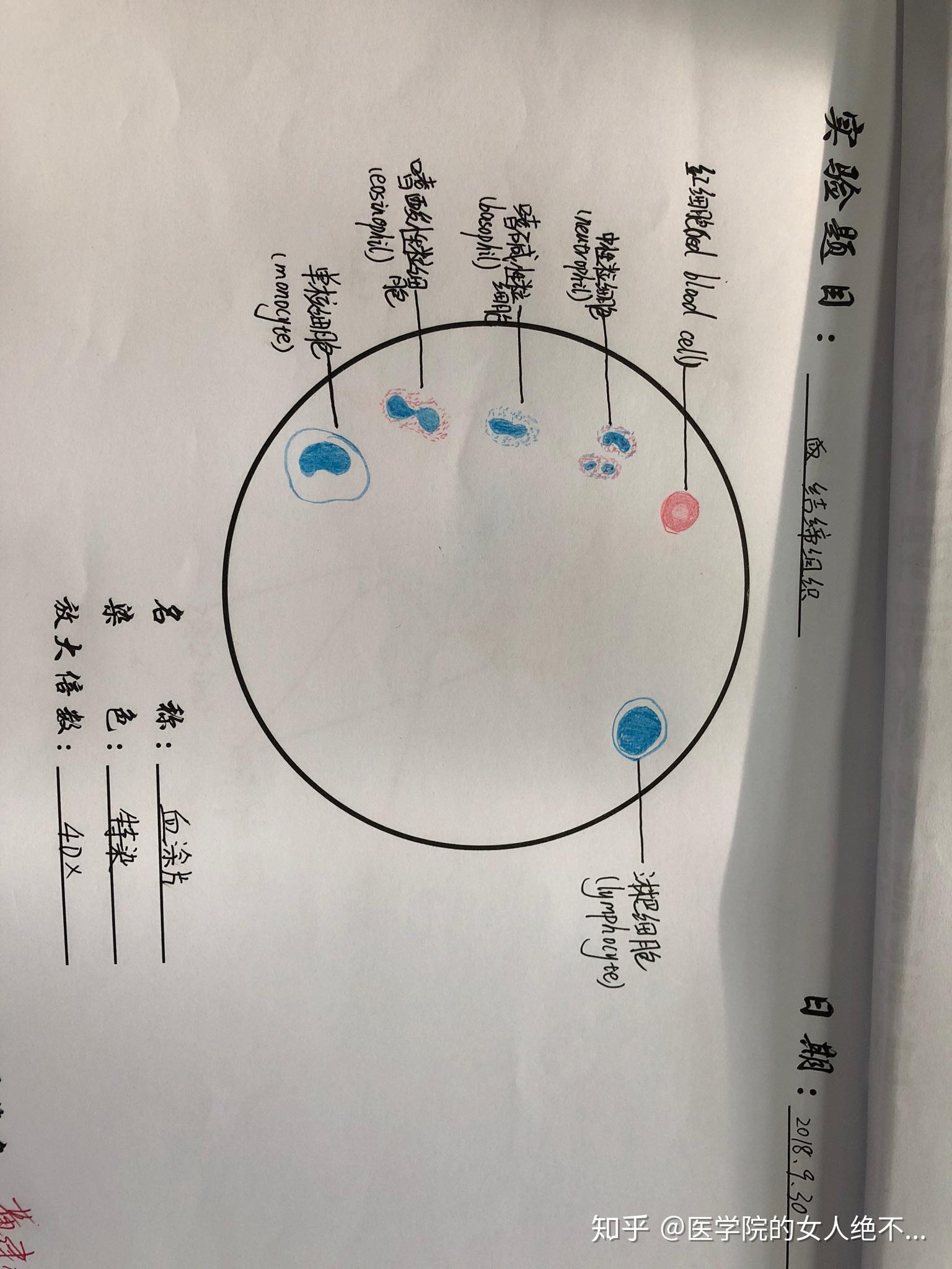 有没有红蓝铅笔血涂片的手绘图