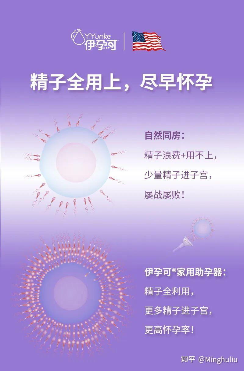 欧美常用助孕手段，伊孕可家用助孕器，试管婴儿般怀孕率！ - 知乎
