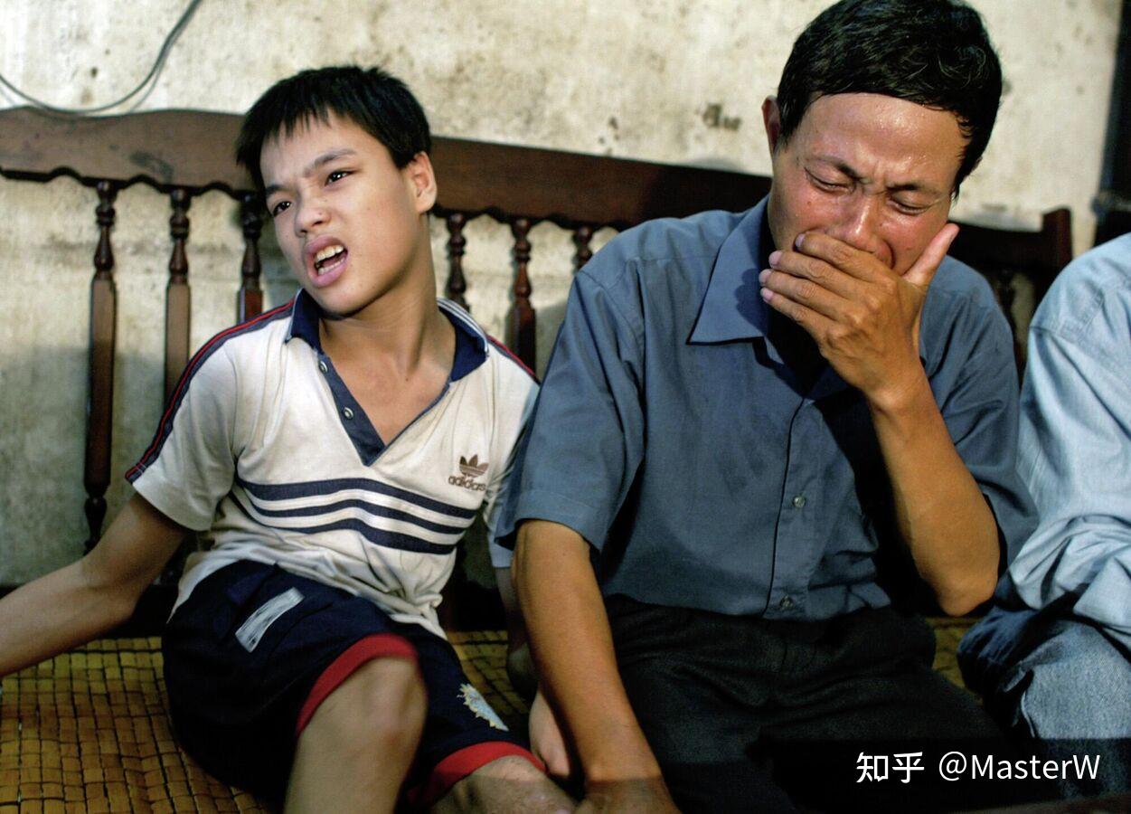 惨绝人寰的灾难：美国在越南实施化学战的恶果延续至今 - 知乎