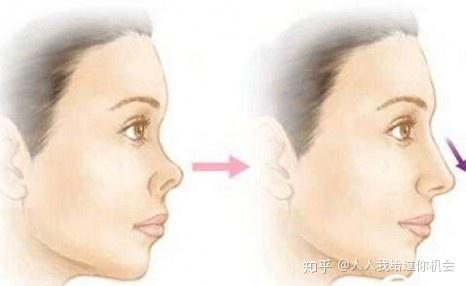 鼻孔外露和朝天鼻的区别!朝天鼻好不好?命运怎么样? - 知乎