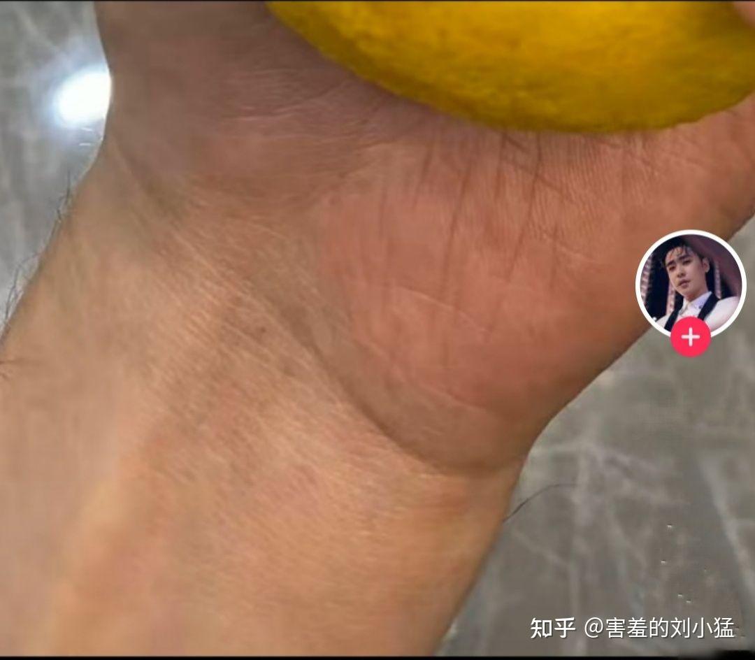 小辫儿张云雷的左手