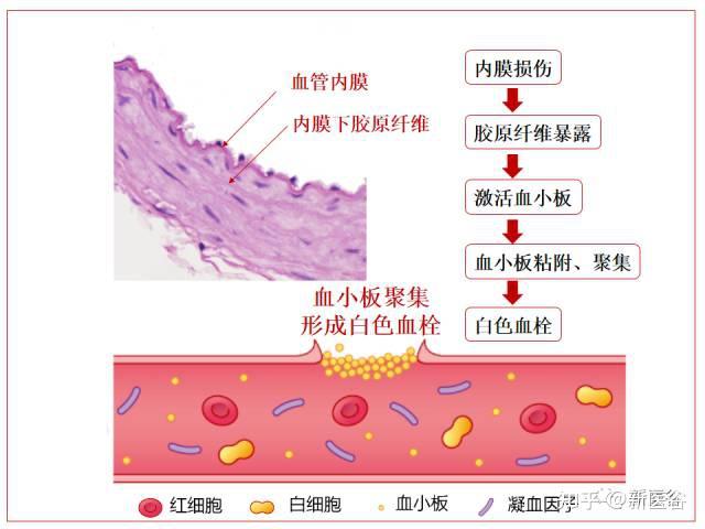 出血如何止？解析止血那些事 生理止血 - 知乎