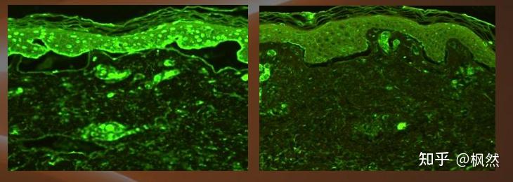 国内外首个抗氧抗糖人体检测标准发布!珀莱雅直接填补行业空白