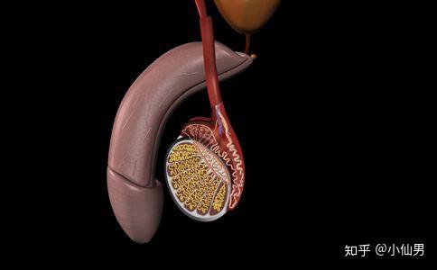 附睾郁积症图片