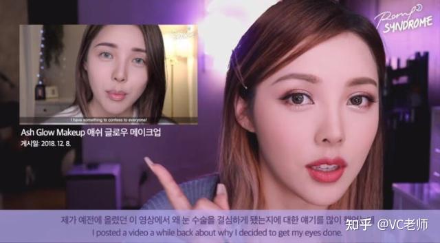 美妆教主pony大方坦承整形两次术后跟粉丝分享术前vs术后