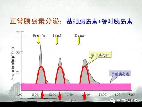 胰岛素泵原理图图片