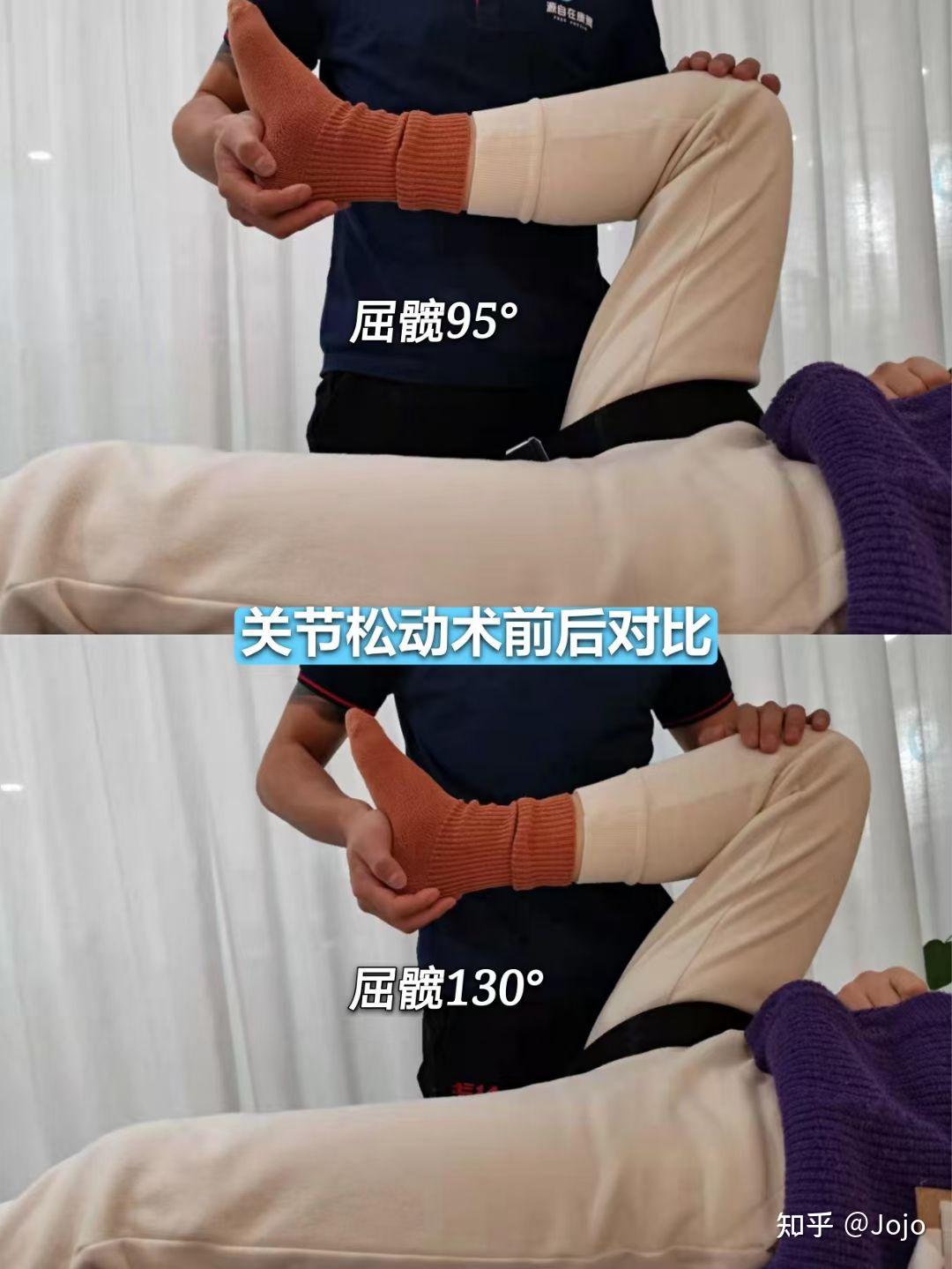 内旋活动度改善伸髋活动度,这是步态调整的重要前提改善肩关节活动度