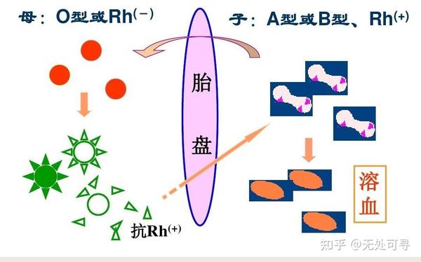 新生儿溶血（儿科学第九版第六章）做PPT可用提炼 - 知乎