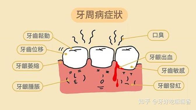 出現糖尿病骨質疏鬆等疾病還可以做種植牙嗎