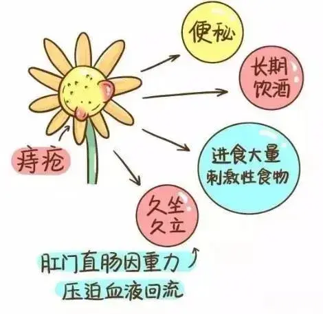 痔瘡外痔肉球怎麼消除必看有絕招