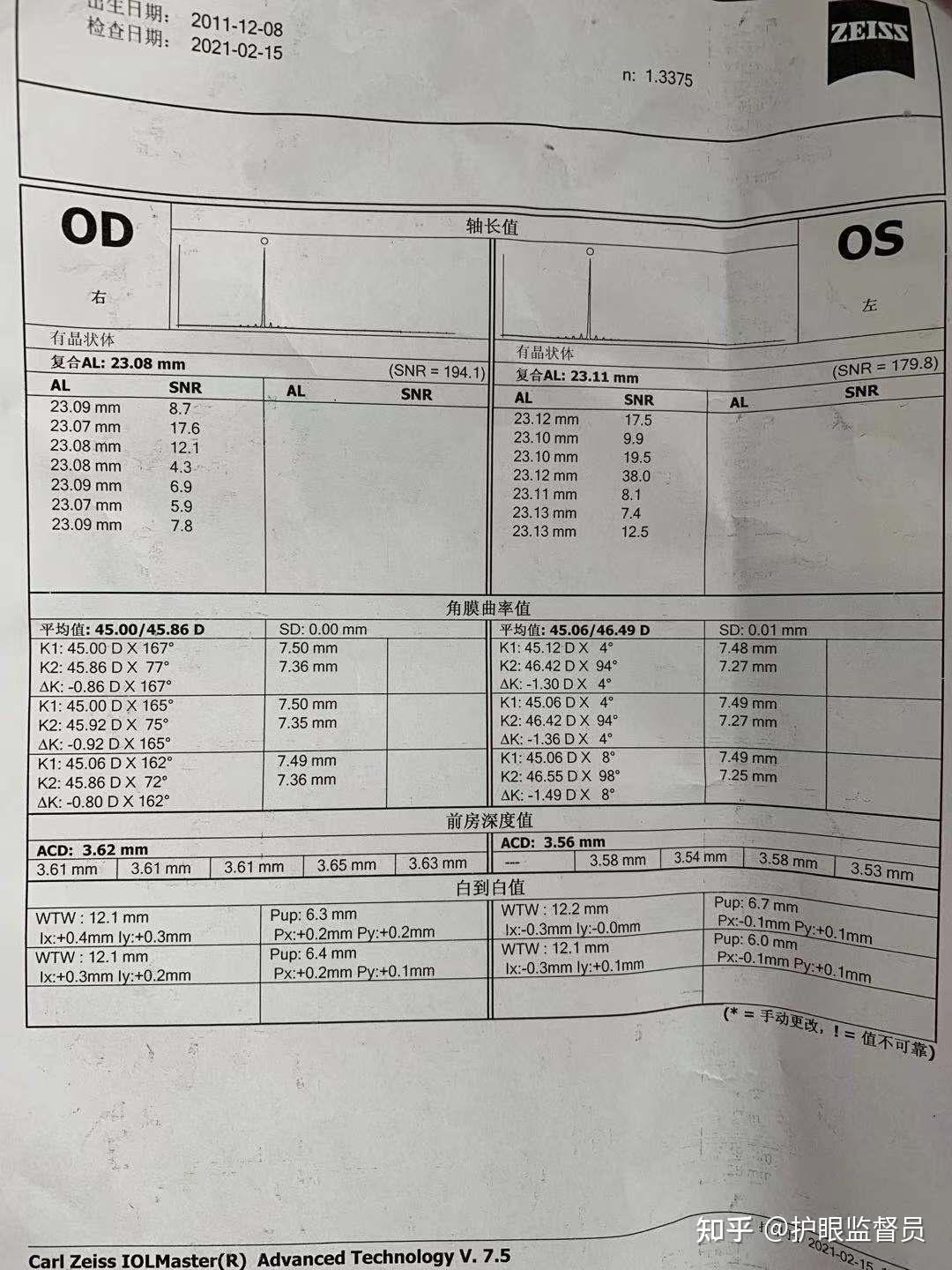 儿童角膜边缘灰色月牙图片