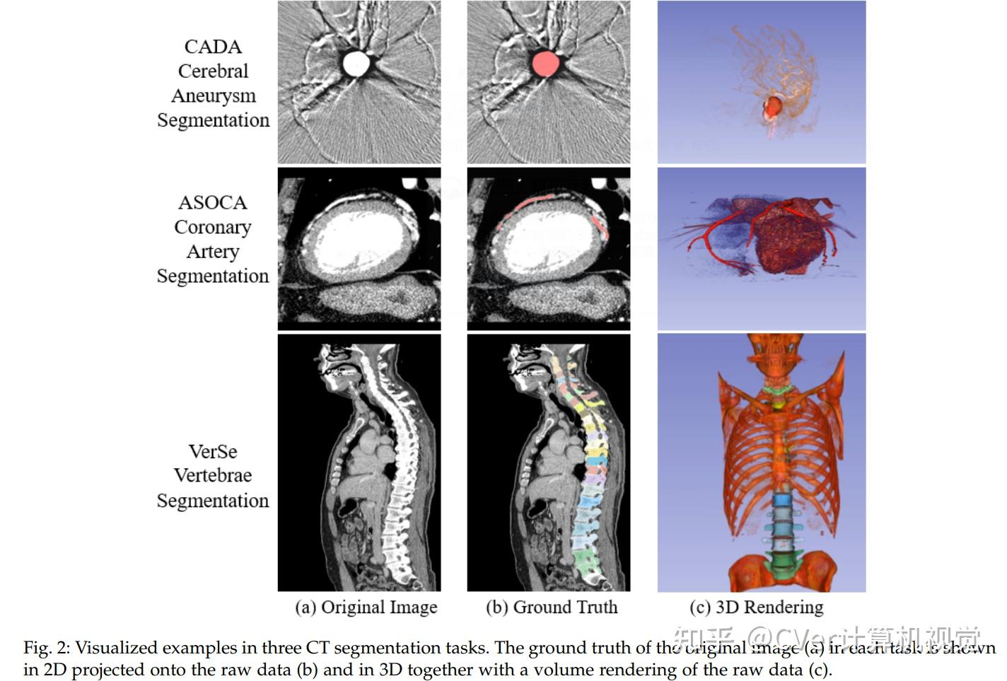 2020年最先进的3d医学图像分割方法