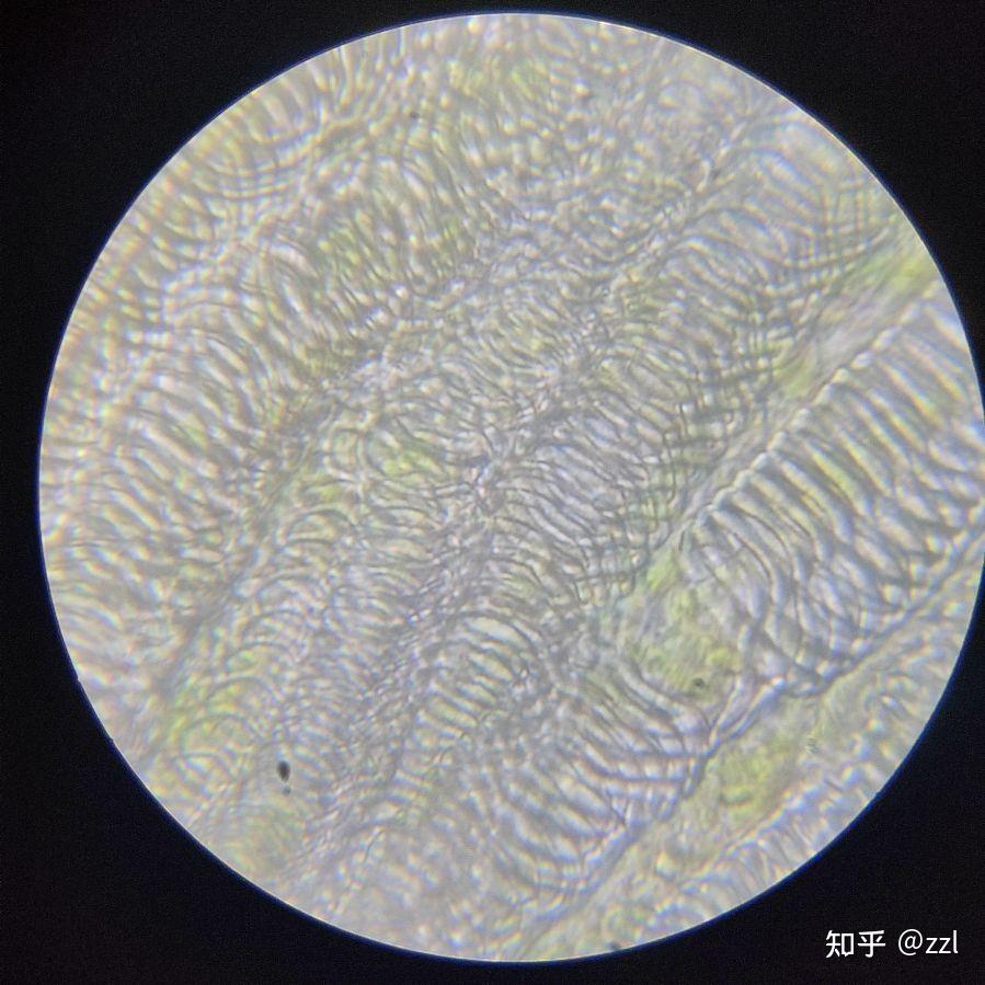 显微镜下绿萝叶片细胞上螺旋装的东西是啥