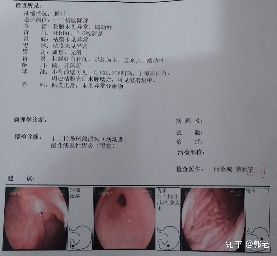 每天都在吃东西,多多少少给胃留下磨损,比如留下点出血点,充血斑