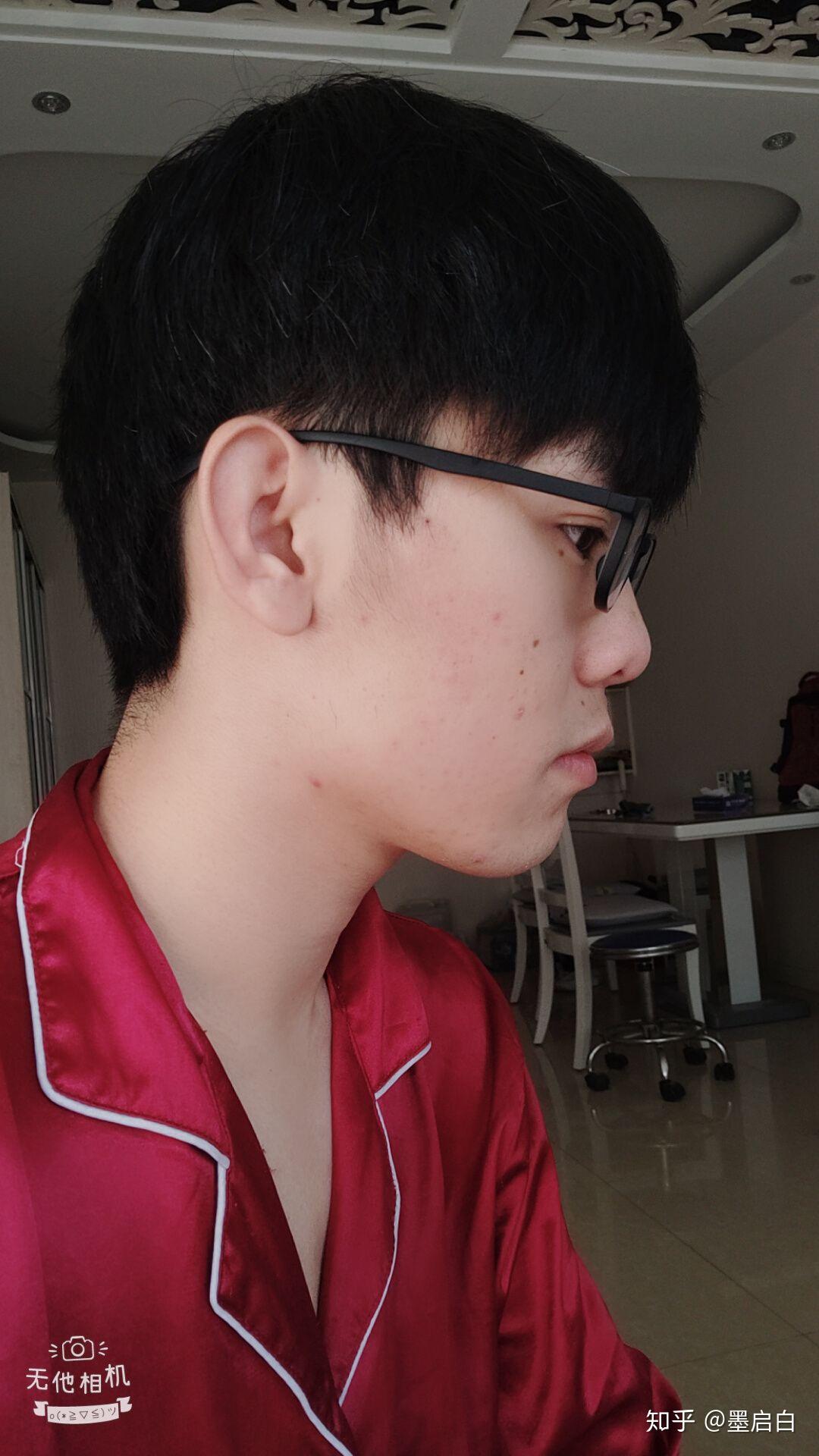 正脸正常侧脸丑到爆是什么体验