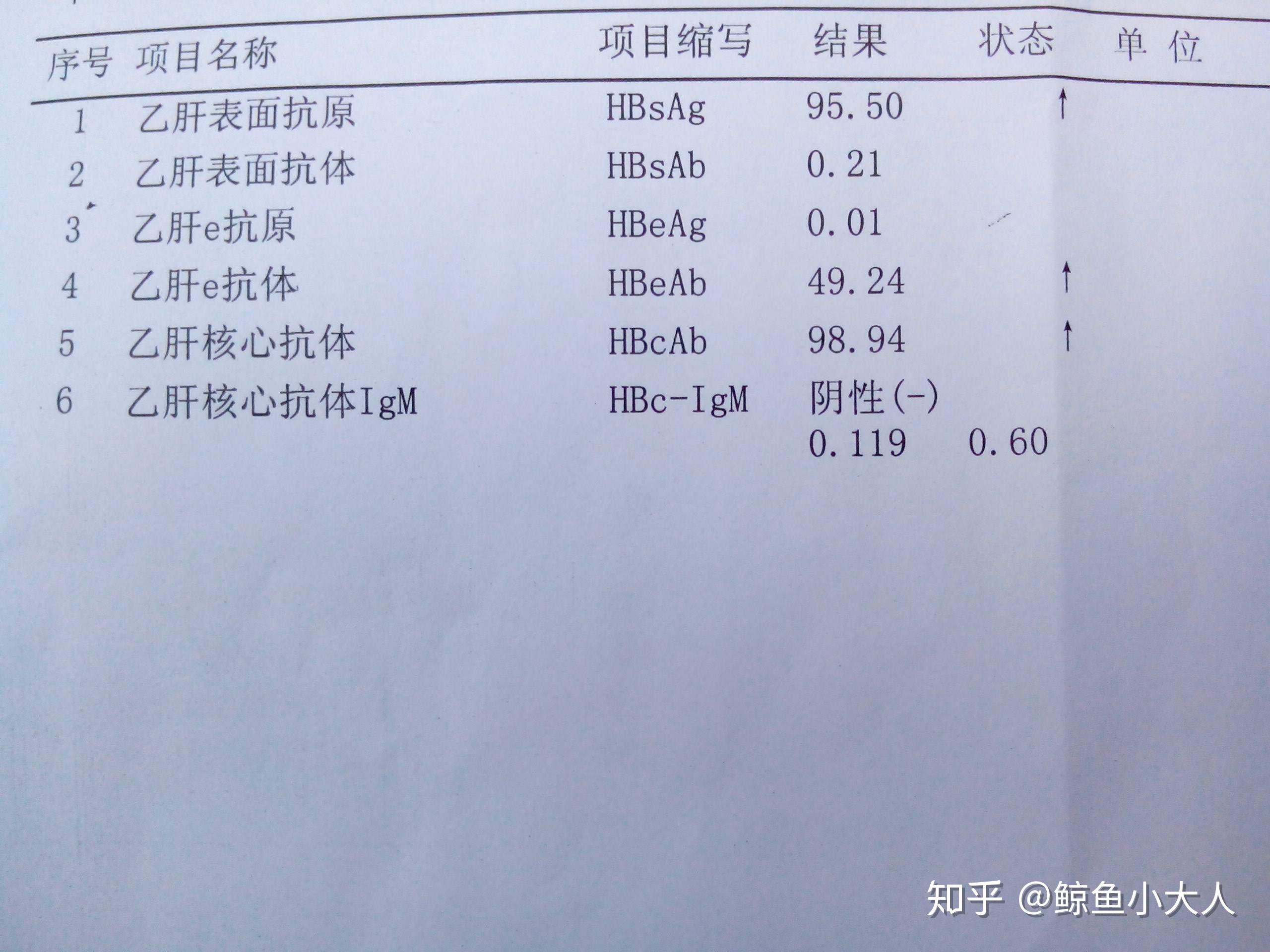 以前人們總認為大三陽比小三陽嚴重,就很容易會忽視乙肝小三陽的複查