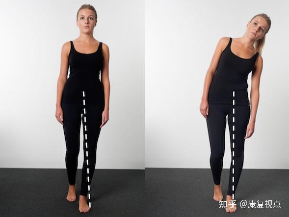 步态分析，详解人类步态和异常步态 - 知乎