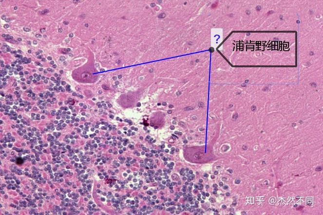 浦肯野细胞手绘图片